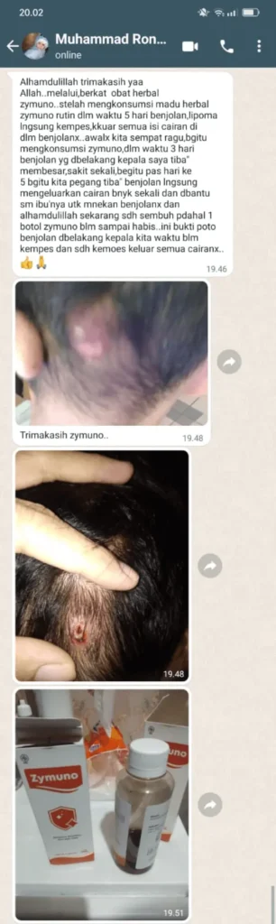 testi-benjolan-sembuh-1.webp