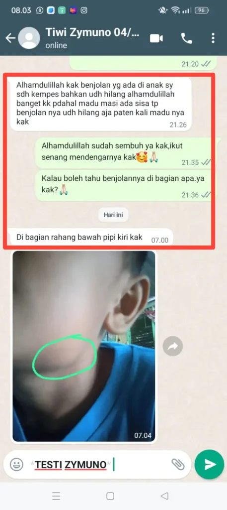 testimoni-benjolan-wajah.webp